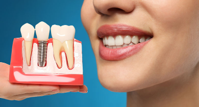 The Life-Changing Benefits of Dental Implants: Function, Aesthetics, and Health