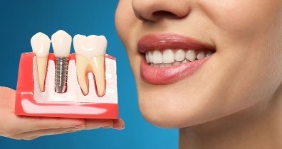 The Life-Changing Benefits of Dental Implants: Function, Aesthetics, and Health
