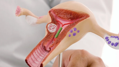 IUI Treatment: A Modern Solution for Fertility Challenges