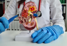 Why Is Friction the Invisible Enemy in Manufacturing Minimally Invasive Medical Devices?