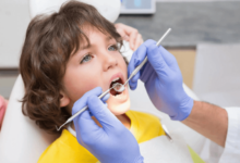 How Childhood Oral Habits Shape Adult Dental Structure and Function