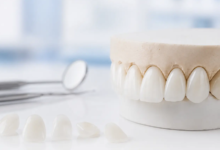 All-on-6 in Turkey: Your Guide to Full-Arch Smile Restoration