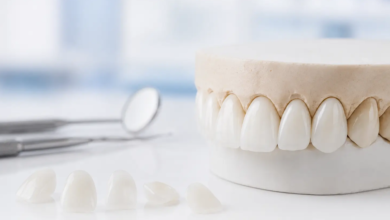 All-on-6 in Turkey: Your Guide to Full-Arch Smile Restoration