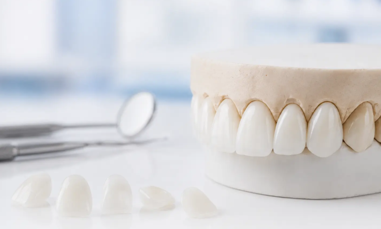 All-on-6 in Turkey: Your Guide to Full-Arch Smile Restoration